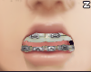 Zkr|Grey Braces