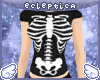 {E}RibCage_Top