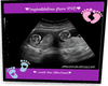 Sissy's Ultrasound 1