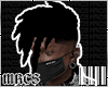 [MRCS] Alt Twists