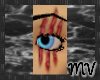 MV Tri Scar Eye