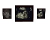 Alayah's Ultrasound Pics