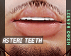 †. Asteri Teeth 02
