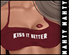 ɳ Kiss it Better M