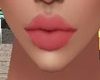 XYLA lips 1