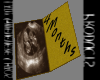 UltrasoundCardTwin4Month