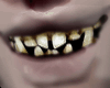 5C Ugly Teeth