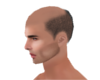 Baldness bald hairstyle