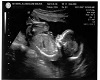 baby  ultrasound picture