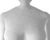 freckles chest