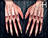 Damaged Hands