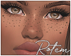 R* Freckles Dark