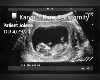 Jolene 3 mo Ultrasound