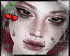 C. Freckles