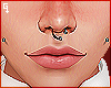 g. Septum + Dimple Prc