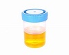 Urine Cup