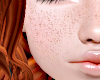 (PH) BlakeV.2: Freckles