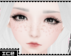 Ice * Raine Freckles