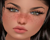 LC Skin freckles