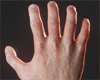 Hand Scaler 90 %