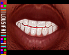 †. M Teeth 06