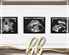 Ultrasound Framed Photos