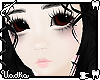 severed T1