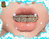 diamond dentures