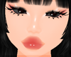 * rednote