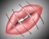Stiched Lips -sticker-
