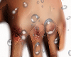 ☠ HURT HAND