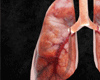 Exclusive lungs F