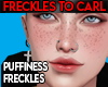 *LK* Freckles to Carl