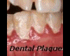 Dental SlideShowPicFrame
