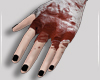 R| BLoody hand
