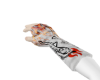 broken arm