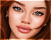 Diane |  ANYSKIN