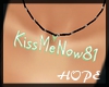 KissMeNow81