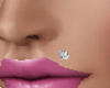Upper Lip Diamond