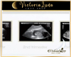 Hospital Ecografia