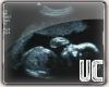 [MsF]UltraSound Pic
