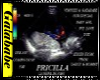 ULTRA SOUND PIC 1 BABY