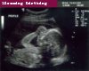 blessings Ultrasound
