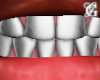 Asteri White Gold Grillz