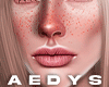 A. Add Freckles