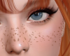 K | HD Freckles