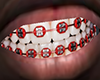 M| Colored Braces v3