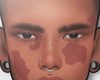 ✱ Birthmarks