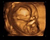 framd ultrasound 16 week