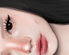 A| ADD Dimples